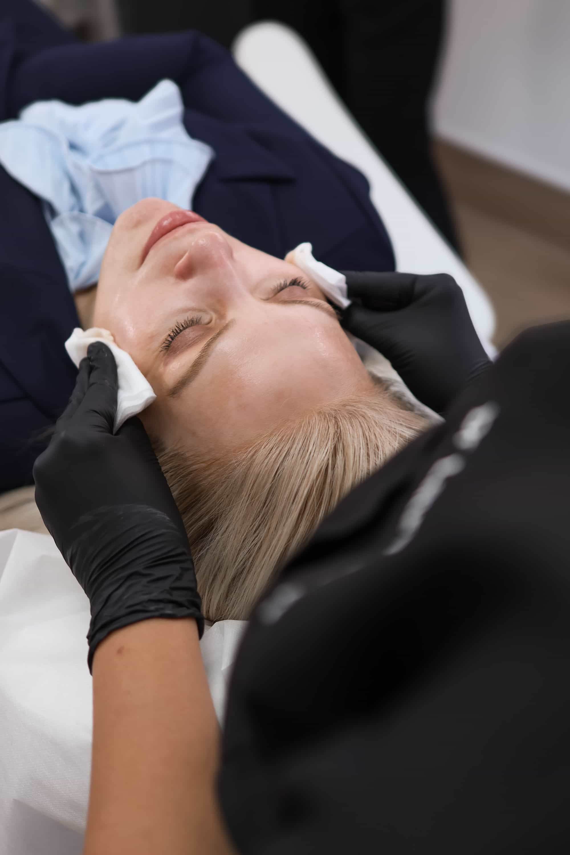 Retinol Peel near Surbiton, Surrey
